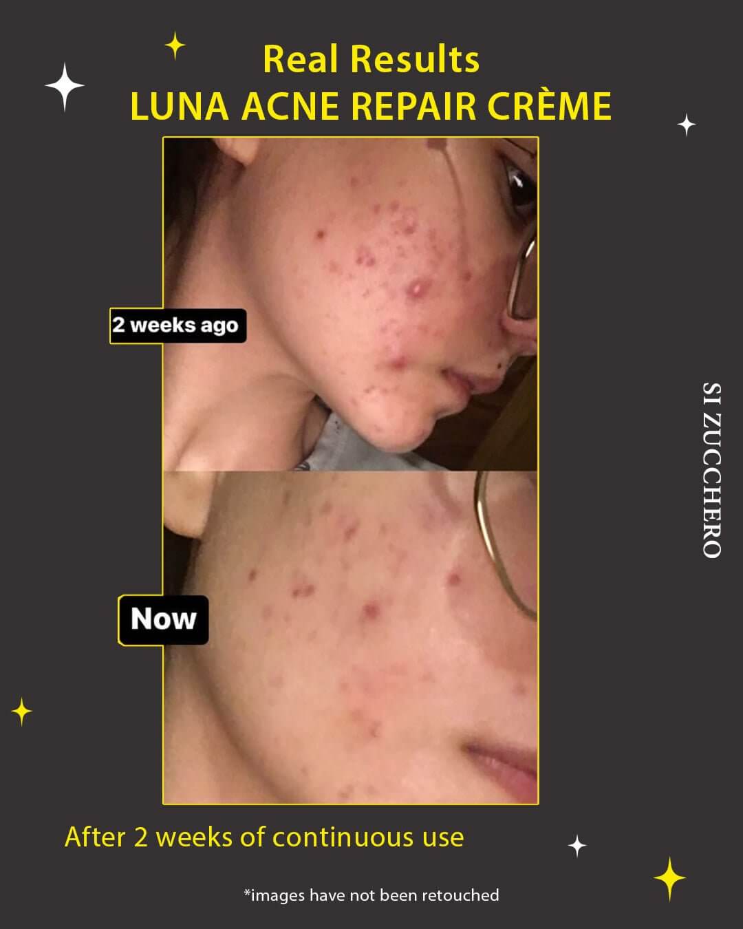 Luna Acne Repair Crème
