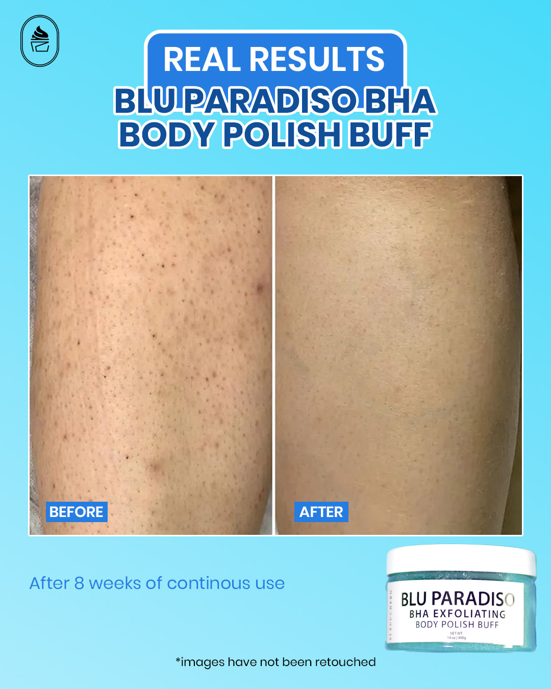 Blu Paradiso BHA Exfoliating Body Polish Buff