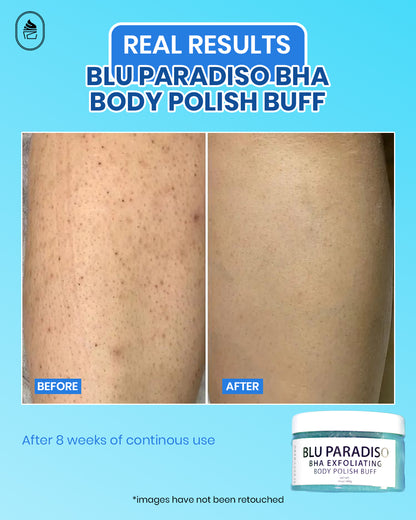 Blu Paradiso BHA Exfoliating Body Polish Buff